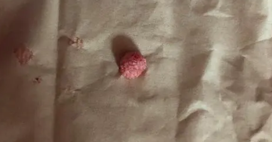 猫结石吃什么药?答案在这里 猫结石吃什么药?答案在这里