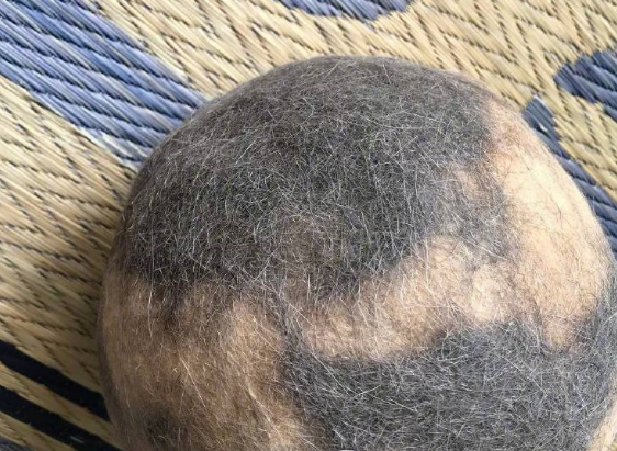 猫咪始终脱毛严重怎么办？猫咪：我怎摸可以不掉这么多多毛！(图1)