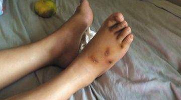 狂犬病有什么症状？这些个反应切尽量(图1)