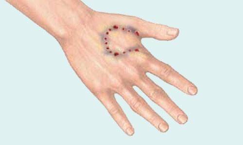 狂犬病人会咬人吗？不首先排除这个(图1)