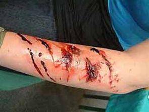 狂犬病会传染吗？传染是有一定的条件的(图3)