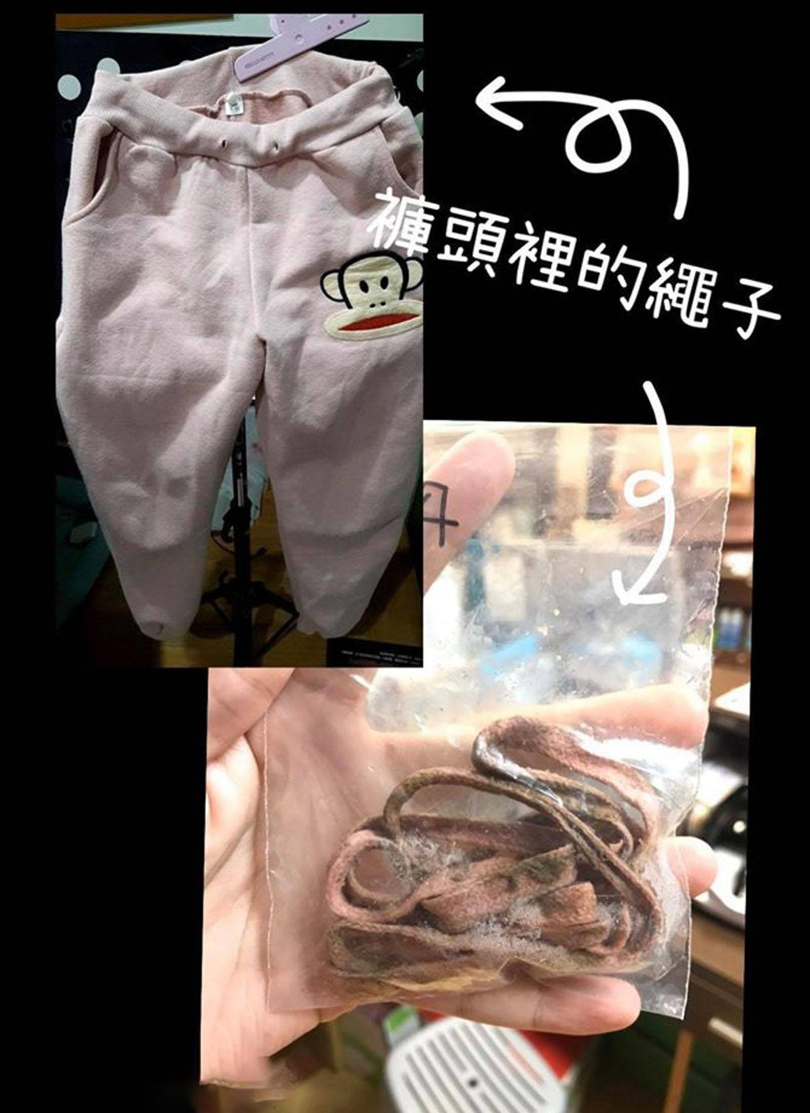 猫咪拉出庞大无比长条异物吓坏主人 医生说全面处理方法不恰当可闪避！(图4)
