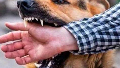 条件符合以下几个特征的狗狗 不能惹 不然咬你没商量商量(图1)