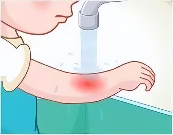 被猫抓伤怎么处理？这些处理细节很重要，缺一不可(图3)