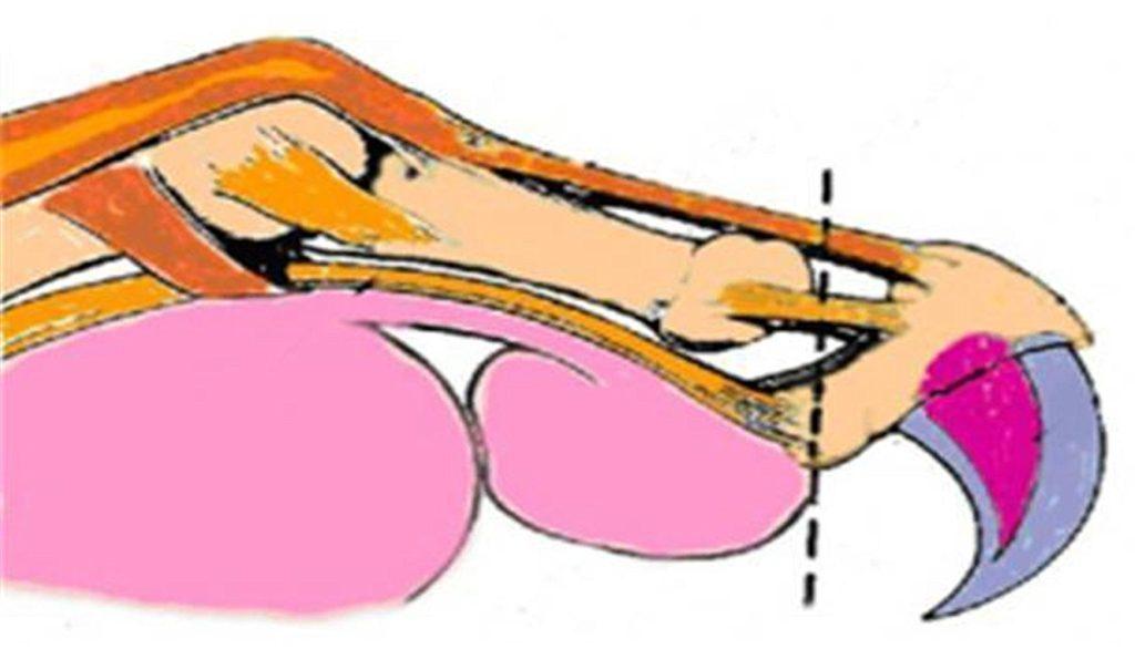 辟谣：被猫抓伤不一定会得猫抓，猫抓病并没有那么可怕！(图8)