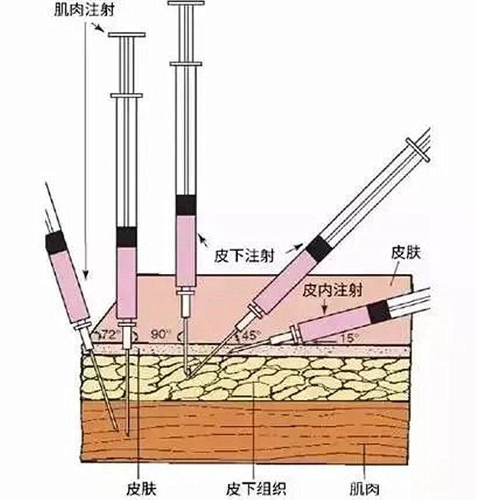 铲屎官在家给猫咪打疫苗，却不知存在多种风险(图4)