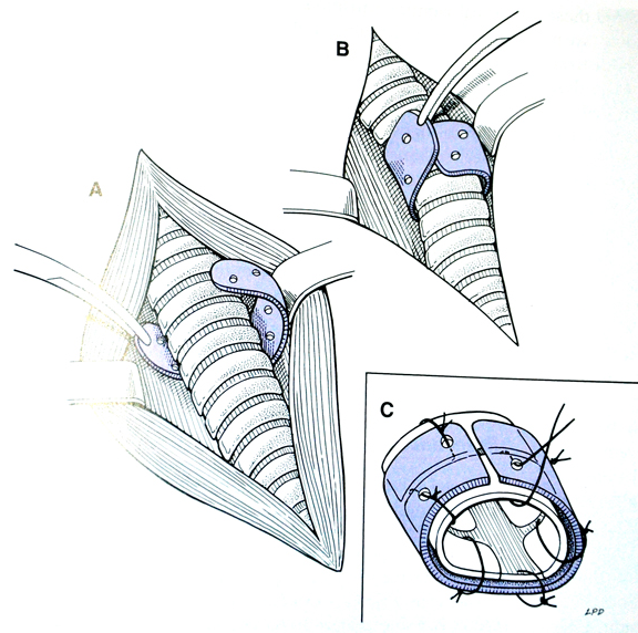 什么是犬气管坍陷？有效预防和治疗很最重要 治疗方法才是关键（狗气管坍陷平时怎莫如何保养）(图9)