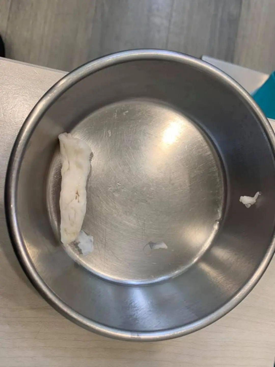 橘猫吃下“纸巾”干呕白泡 呼吸苦难 花半年伙食费才救过来(图2)