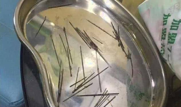 女子摸猫咪时 它表现得太伤痛 带去医院拍个片子后吓到了(图4)