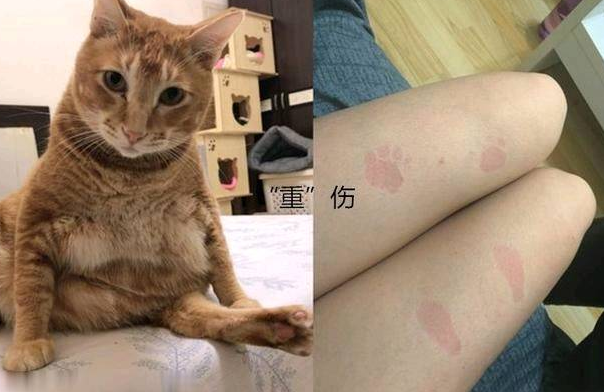 女子抱了10分钟橘猫双腿就受了“重伤”拍下照片让人羡慕(图2)