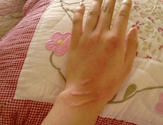 铲屎官们还能够娱快“吸猫”吗？(图2)