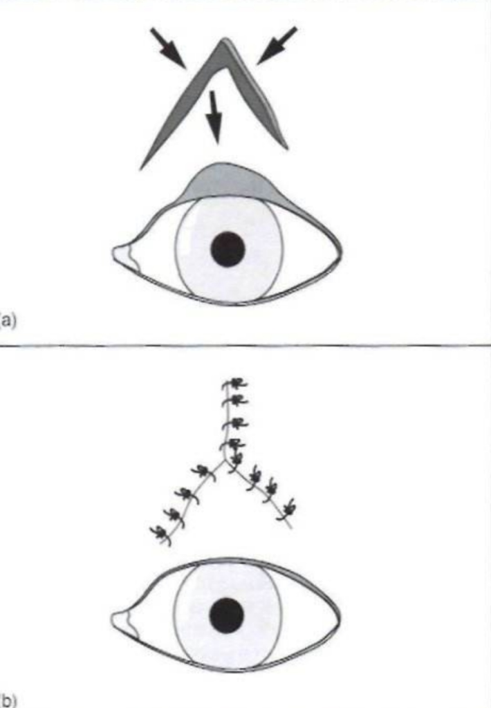 狗狗倒睫毛、眼睑内翻、外翻的治疗方式（狗狗倒睫毛,眼睑内翻,外翻的治疗方式是什么）(图9)