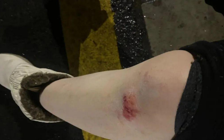 苏州偷猫曝光!当事人被偷猫贼拖行致脑震荡(图27)