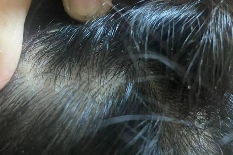 苏州偷猫曝光!当事人被偷猫贼拖行致脑震荡(图28)