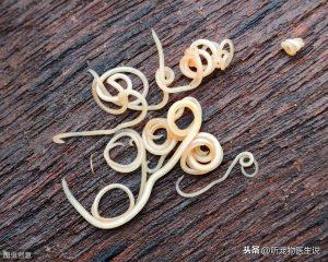 了解猫狗这6种常见体内寄生虫,怎么去预防它?(图2)