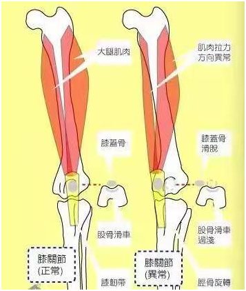 什么是狗狗髌骨脱位?才能避免狗狗们得这种病?(图2)