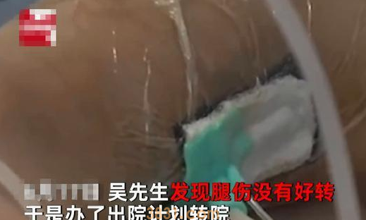 小猫偷吃东西,男子打它一下反被咬,小腿感染肿得像气球(图2)