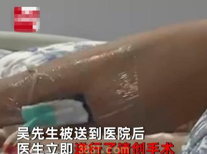 小猫偷吃东西,男子打它一下反被咬,小腿感染肿得像气球(图3)