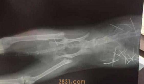 女子摸猫咪时,它表现得非常痛苦,带去医院拍片后吓坏了(图3)