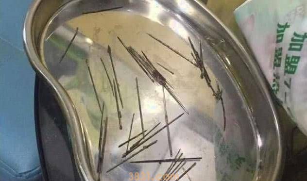 女子摸猫咪时,它表现得非常痛苦,带去医院拍片后吓坏了(图4)