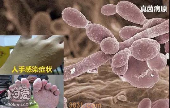 猫藓会传染给人吗 撸猫需谨慎预防猫癣(图1)