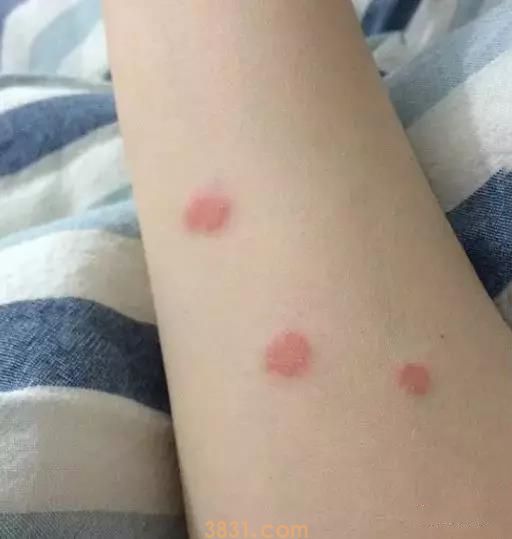 猫藓用什么药膏 人也要注意被传染哦!(图2)